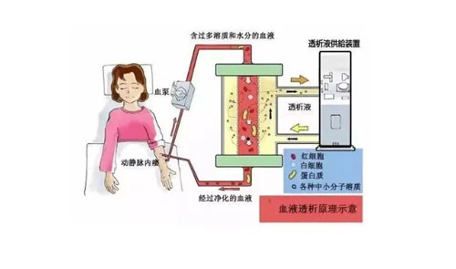 血液透析的十大禁忌